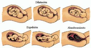الولادة 300x161 - أعراض-الولادة